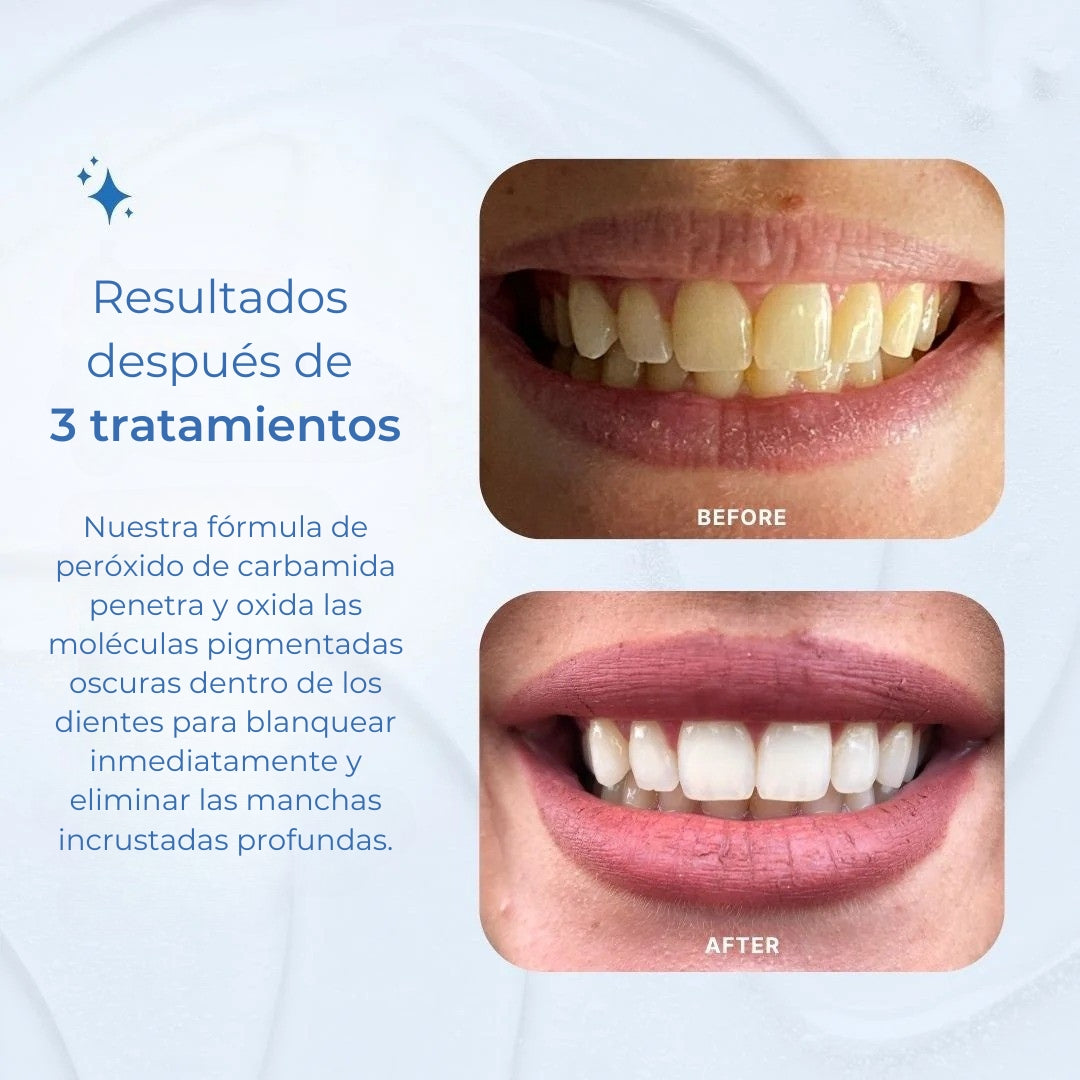 PurifyWhite | Blanqueador Dental Profesional