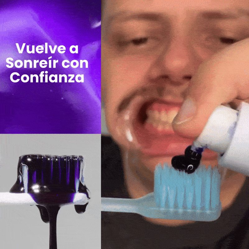 SmileKit | Pasta de dientes blanqueadora